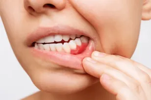 Periodontia