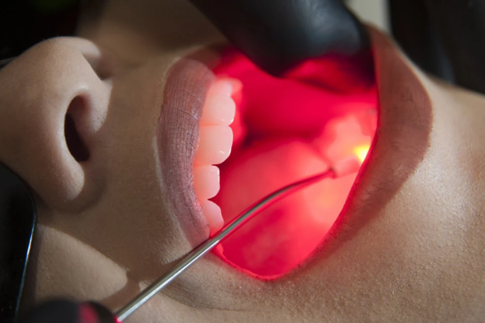 Laser odontológico