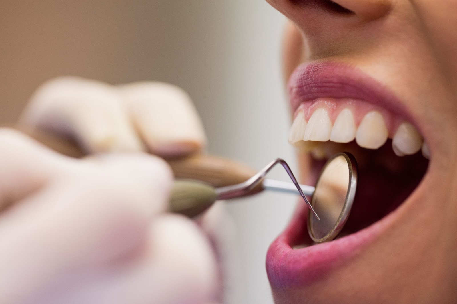 Doenças na boca mais comuns atualmente e como evitá-las