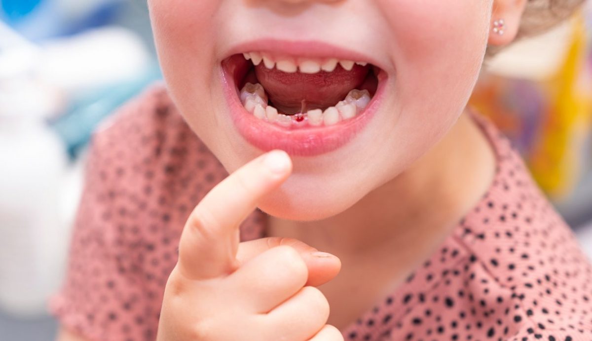 Conheça os cuidados no período de formação dos dentes