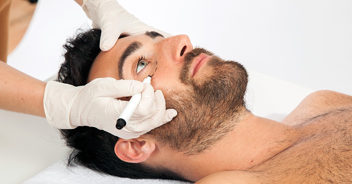 Os principais procedimentos na harmonização facial masculina