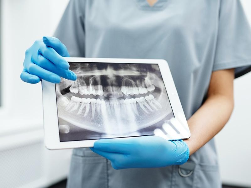 Radiografia panorâmica – Qual sua importância no tratamento odontológico?